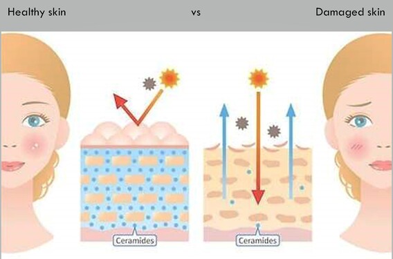 Ceramide dalam kulit yang sihat vs kulit yang rosak
